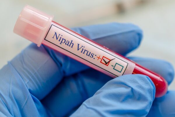 Нипа вирусът: Повишена заплаха и мерки за контрол.